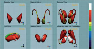 Figura 6