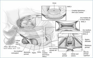 Anatomía funcional del piso pelviano Traducido de: Pelvic Floor Dysfunction. A Multidisciplinary Approach. Editores. G Willy Dávila, Ghamal M Ghoniem, Steven D Wexner. Sección IV Anatomic Correlates. 4-1 Urologic Anatomic Correlates. Pág. 74. Jonathan Jay.