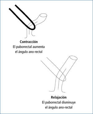 La función del piso pelviano en el mantenimiento de la continencia y la facilitación de la defecación Representación gráfica de la manera en que el músculo puborrectal influye en la continencia (cuando está contraído) y defecación (cuando está relajado) a través de sus efectos en el ángulo ano-rectal.