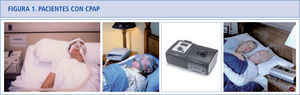 Diferentes gamas y modelos. La parte superior de la imagen representan pacientes en tratamiento con CPAP con modelos de diferente antigüedad. La parte inferior representan imágenes recientes de pacientes en tratamiento con auto-CPAP.