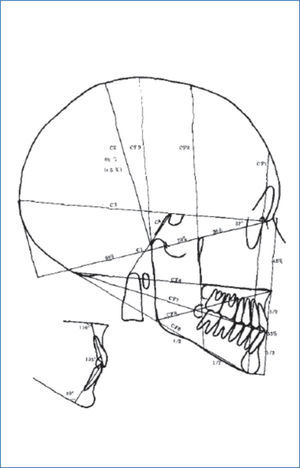 Análisis estructura y arquitectural del esqueleto cráneo facial de Jean Delaire (18).