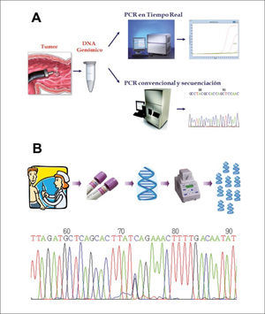 Esquema general de las estrategias para estudio de mutaciones (A) El estudio de mutaciones somáticas se realiza a partir del DNA extraído de una pieza tumoral. Es amplificado mediante PCR y estudiado por secuenciación o PCR en tiempo real, técnica que incorpora partidores fluorescentes que permiten aumentar enormemente la sensibilidad y disminuir los tiempos de trabajo. (B) El estudio de mutaciones de línea germinal se realiza a partir del DNA extraído de una muestra de sangre del paciente. Se amplifica mediante PCR y se secuencia en busca de mutaciones, las que se visualizan en un electroforetograma como el doble peak correspondiente al nucleótido 73 de la secuencia mostrada.