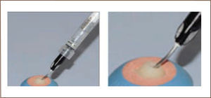 Aplicación de silano (ultradent)