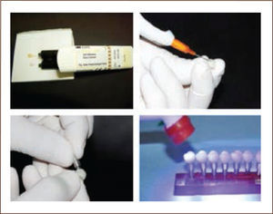 Procedimiento de cementación