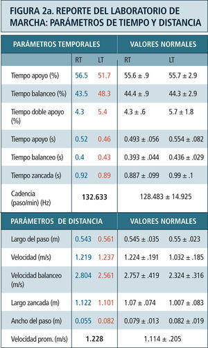 Destaca en color azul valores lado derecho y en rojo el izquierdo. Ciclo de marcha representado en función del tiempo del 0 a 100%. Línea vertical ubicada alrededor del 60% representa momento del despegue del pie, dividiendo las fases de apoyo y balanceo. Franja en achurado gris representa rango de valores de normalidad. Examen correspondiente a paciente portador de idiopatic toe walking.