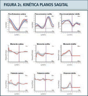 Destaca en color azul valores lado derecho y en rojo el izquierdo. Ciclo de marcha representado en función del tiempo del 0 a 100%. Línea vertical ubicada alrededor del 60% representa momento del despegue del pie, dividiendo las fases de apoyo y balanceo. Franja en achurado gris representa rango de valores de normalidad. Examen correspondiente a paciente portador de idiopatic toe walking.