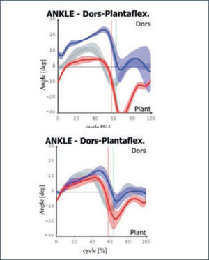 Curva de consistencia kinemática sagital tobillos de un paciente hemipléjico pre y post entrenamiento con el lokomat