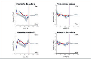 Kinética sagital de caderas de un paciente displéjico antes y después del entrenamiento con el lokomat