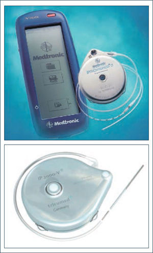 Dos Ejemplos de Dispositivos Implantables Para Baclofeno Intratecal Existentes en el Mercado