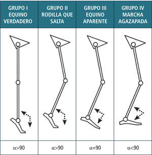 Evolución marcha agazapada Sutherland DH, Davids JR. Common gait abnormalities of the knee in cerebral palsy. Clin Orthop Relat Res. 1993 Mar;(288):139-47.