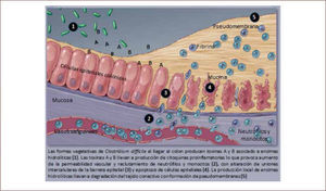Patogenia de la infección por Clostridium difficile