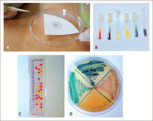 Diferentes tipos de pruebas metabólicas y bioquímicas A)Test directo (Oxidasa).B)Batería bioquímica.C)Galería bioquímica.D)Placa con medio cromógeno.