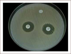 Prueba de susceptibilidad antimicrobiana por difusión con disco o método de kirby-bauer Prueba de susceptibilidad antimicrobiana por difusión con disco o método de Kirby-Bauer.