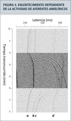 Se ilustra el registro intraneural en el nervio peroneo superficial de un individuo sano desde cuatro axones no mielinizados con un campo receptivo muy similar en la piel del dorso del pie, desde donde se estimula eléctricamente con una frecuencia de 0.25Hz (un impulso cada cuatro segundos) con un intervalo de tres minutos con una tétano de 2Hz. Durante este período la latencia de las respuestas individuales varía notablemente. Mientras la unidad a enlentece poco y alcanza una meseta, las unidades b y c lo hacen en una proporción mucho más grande sin llegar a estabilizarse. La unidad d, por su parte, se enlentece rápido para luego adaptarse e incluso recuperarse parcialmente durante la estimulación tetánica. La unidad a corresponde a una fibra específica de frío, las unidades b y c son nociceptores polimodales, mientras que la d es una fibra simpática sudomotora.