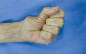 Preoperatorio