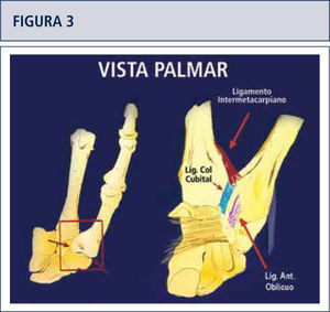 La estabilidad de los ligamentos en torno a la articulación son esenciales en el desarrollo de la artrosis