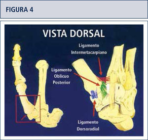 La estabilidad de los ligamentos en torno a la articulación son esenciales en el desarrollo de la artrosis