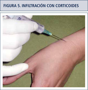Figura 5