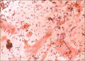 Lacto bacillus SP Presencia de Lactobacillus sp en cultivo de flujo vaginal.