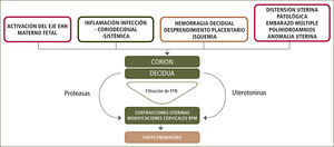 Etiología parto prematuro FFN: Fibronectina Fetal. EHH: Eje Hipotálamo-Hipofisiario.
