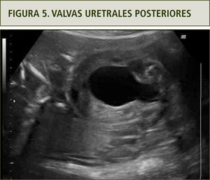 Signo de la cerradura.