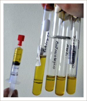 TUBOS PARA ANÁLISIS LÍQUIDO PLEURAL.