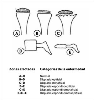 Anormalidades radiológicas útiles en el proceso de clasificación de laS displasias esqueléticas.