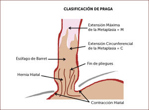 Clasificación de Praga