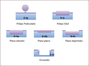 Clasificación de París Ref. 8.