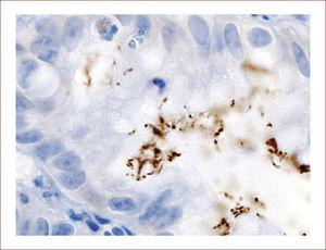 H. pylori, en la cripta gástrica