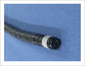 Endosonógrafo radial.