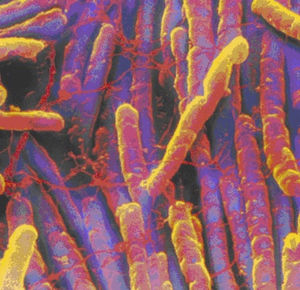 Microscopia electrónica –Clostridium Difficile.