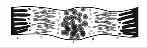 DIAGRAMA DE 5 ZONAS Y 4 ÁREAS DE TRANSICIÓN DEL CALLO ÓSEO EN ELONGACIÓN a) Zona central b) zona paracentral c) zona proximal-distal, d) área de vasculogénesis, e) frentes de mineralización.