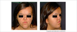FOTOGRAFÍAS PREOPERATORIAS.