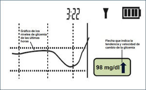 EJEMPLO DE GRÿFICA EN LA PANTALLA DEL RECEPTOR DE UN CGM-RT Modificado de Tumminia A. et al. Patient Preference and Adherence 2015:9 1263⿿127035.