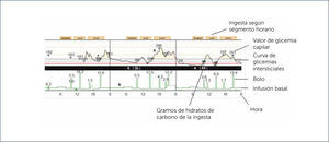 EJEMPLO DE REPORTE DESCARGADO A PARTIR DE UN DISPOSITIVO DE SAPT Modificado de Tumminia A. et al. Patient Preference and Adherence 2015:9 1263⿿127035.