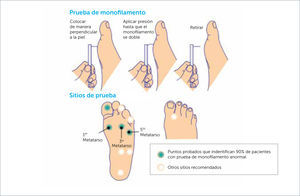 PRUEBA DEL MONOFILAMENTO DE 10 GRS. MINISTERIO DE SALUD