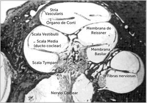 SECCIÓN DE HUESO TEMPORAL HUMANO A NIVEL DE LA CÓCLEA