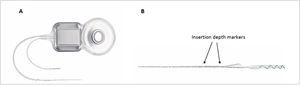 IMPLANTE INTERNO CI522 Implante interno CI522 (A) y detalle de la guía de electrodos Slim-Straight (B), mostrando los indicadores de profundidad para la inserción.
