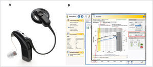 CP910 SOUND PROCESSOR A) El Procesador de Sonido CP910 acoplado al componente acústico (ACO) equipado con un inserto para el canal auditivo en forma de domo. B) software de ajuste EEA integrado (Custom Sound).