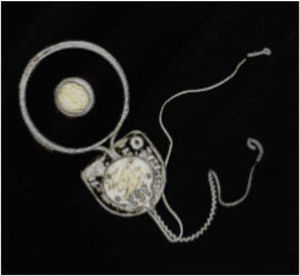 IMPLANTE COCLEAR COCLOCADO EN HUMANO Sistema de extraccion de imagen que permite evitar toda señal (Universidad de Las Palmas).