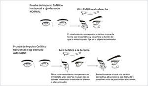 PRUEBA DE IMPULSO CEFÁLICO