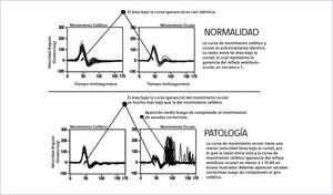 INTERPRETACIÓN DEL VIDEO-IMPULSO CEFÁLICO