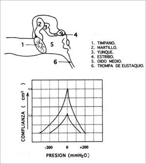 IMPEDANCIOMETRÍA NORMAL