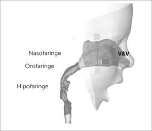 FARINGE Traducido de: Breathing resistance and ultrafine particle deposition in nasal-laryngeal airways of a newborn, an infant, and an adult. Jinxiang Xi, Ariel Berlinski, Yue Zhou, Bruce Greenberg and Xiawei Ou. Annals of Biomedical Engineering, Vol. 40, No. 12, December 2012 (_2012) pp. 2579-2595. DOI: 10.1007/s10439-012-0603-7.