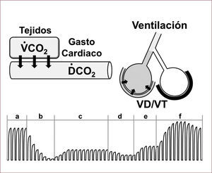 FACTORES DETERMINANTES DEL CO2 FINAL ESPIRADO Factores determinantes del CO2 final espirado incluyen la producción tisular de CO2 (VCO2), el gasto cardíaco transportando el CO2 a los pulmones (DCO2), la proporción de ventilación alveolar que puede disminuir por aumento del espacio muerto (VD/VT) representado en la figura por obstrucción de una arteria pulmonar, y la ventilación. El trazado inferior de capnografía ilustra eventos a observar durante una reanimación cardio-pulmonar: (a), condición basal; (b), cese circulatorio con lavado pulmonar de CO2 en caso de que se mantenga ventilación artificial; (c), compresión torácica generadora de flujo sanguíneo; (d), fatiga del rescatador; (e), rescatador descansado y utilizando técnica más vigorosa; y (f), retorno de la circulación espontánea.