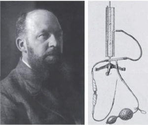 George Kelling y su insuflador manual para realizar pneumoperitoneo