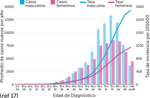Incidencia por edad y género al diagnóstico.