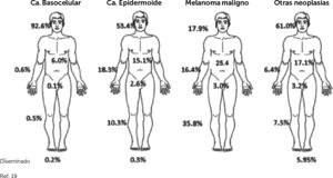 Frecuencia CPNM según localización anatómica.