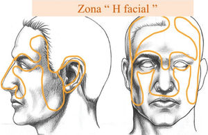 Zona H piel facial